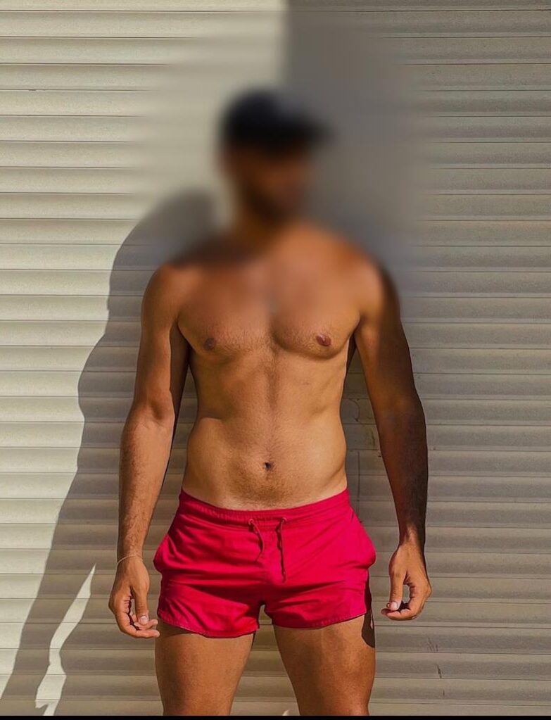 WhatsApp-Image-2023-01-09-at-14.16.53 גבר עומד מול קיר עם תריסים לבנים, לובש מכנסיים קצרים אדומים וכובע, הגוף מטושטש בפנים ובפרטים מזהים.